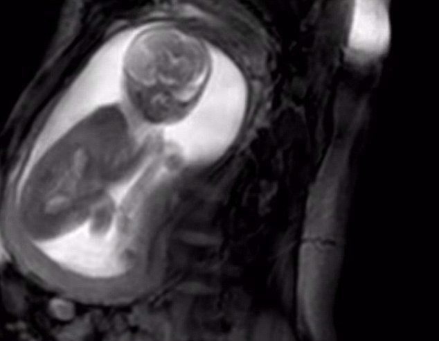 مشاهده قلب جنین انسان ممکن می‌شود +تصاویر