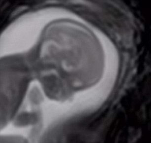 مشاهده قلب جنین انسان ممکن می‌شود +تصاویر