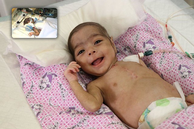 خارج کردن توده از قلب نوزاد سه ماهه در بابل +عکس