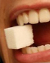 آنچه که باید درباره پوسیدگی دندان بدانید