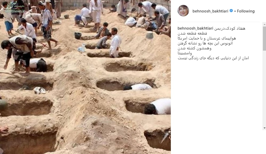 عکس/ واکنش بهنوش بختیاری به کشتار کودکان یمنی