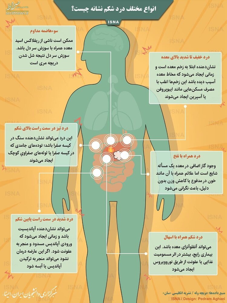 انواع مختلف درد شکم 