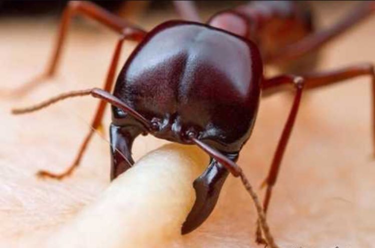 عکس / گاز گرفتن مورچه از نزدیک