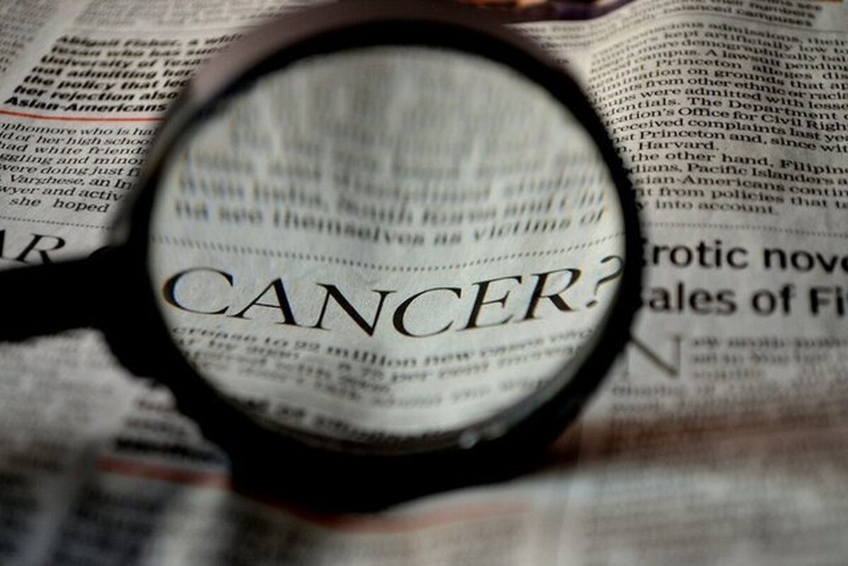 سرطان پروستات دومین سرطان شایع مردان ایرانی است