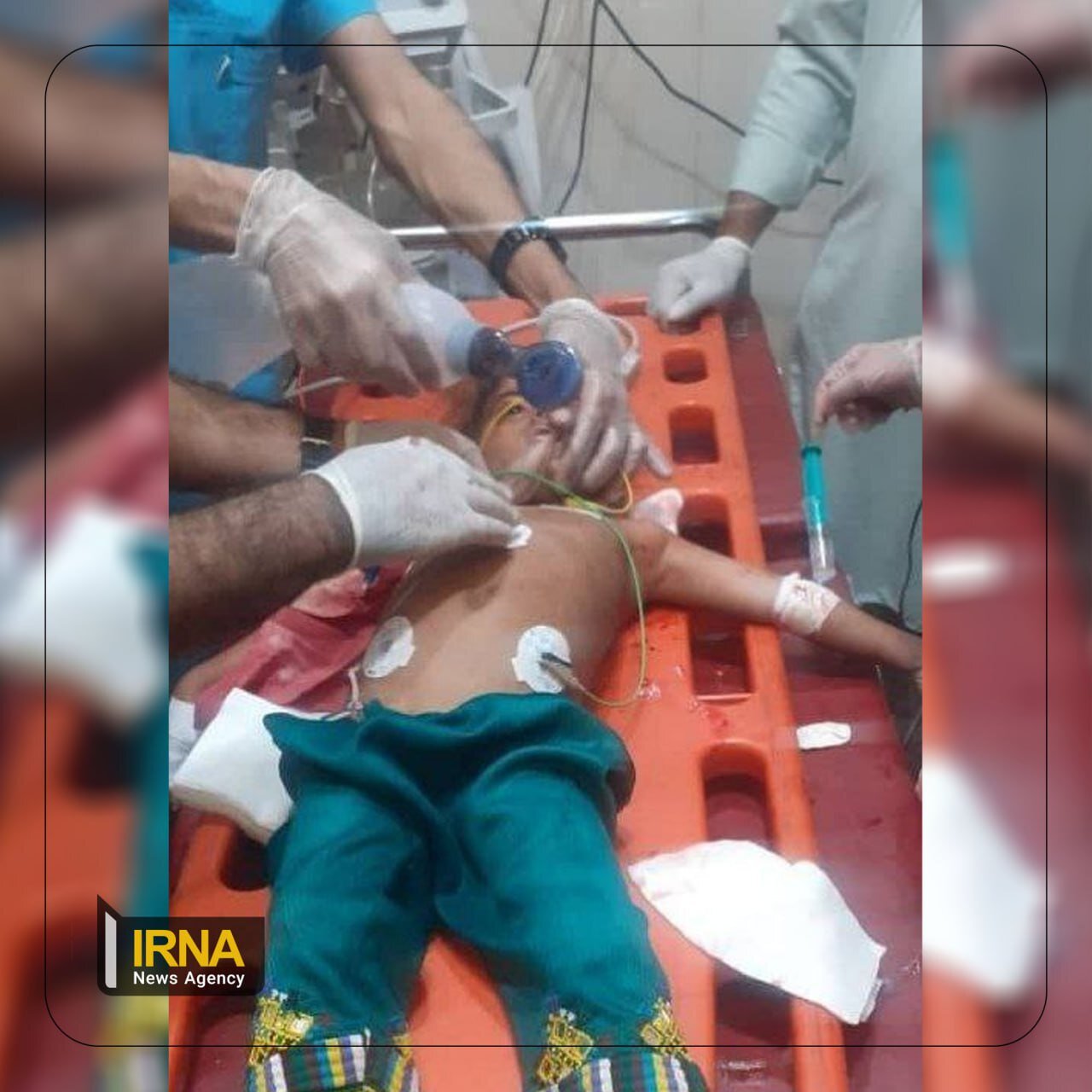 عکس | کودک مجروح‌شده در حملات تروریستی گروهک جیش‌الظلم