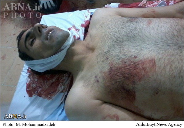 عکس/ ترور بسیجی بلوچ اهل سنت عکس/ ترور بسیجی بلوچ اهل سنت