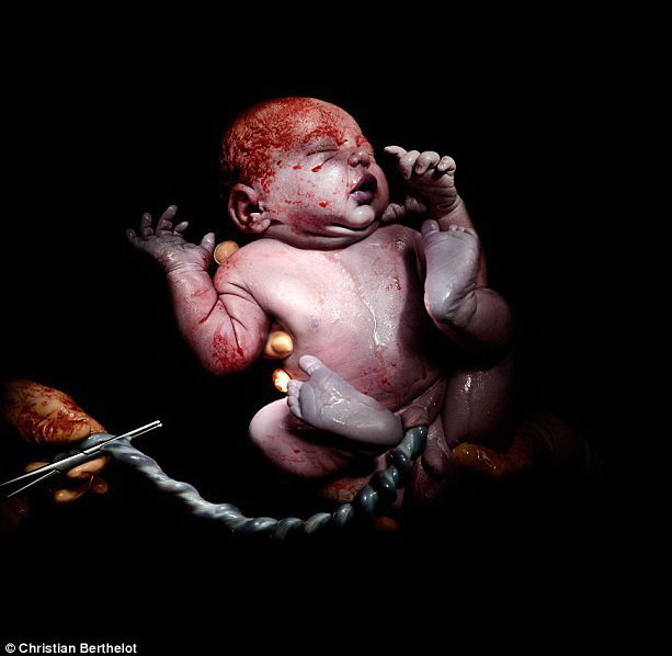 عکس/ لحظه تولد یک نوزاد