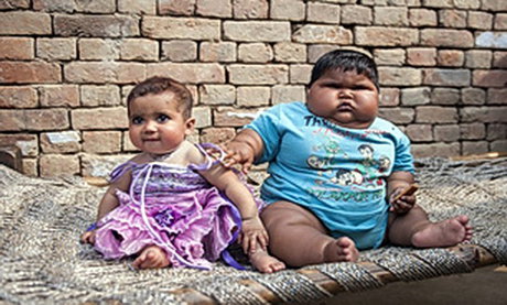 نگرانی از چاقی مفرط کودک هندی +عکس