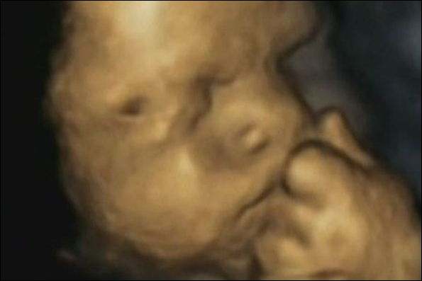 تصاویر انتقال استرس مادر به جنین