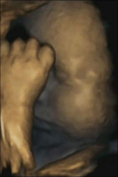 تصاویر انتقال استرس مادر به جنین