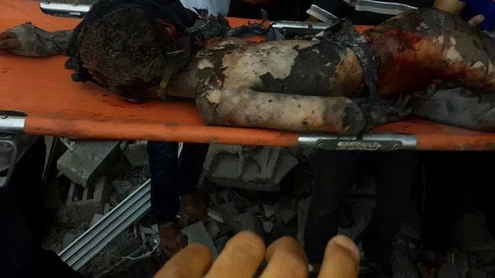 تازه‌ترین جنایت صهیونیست‌ها در غزه+ تصاویر(18+)
