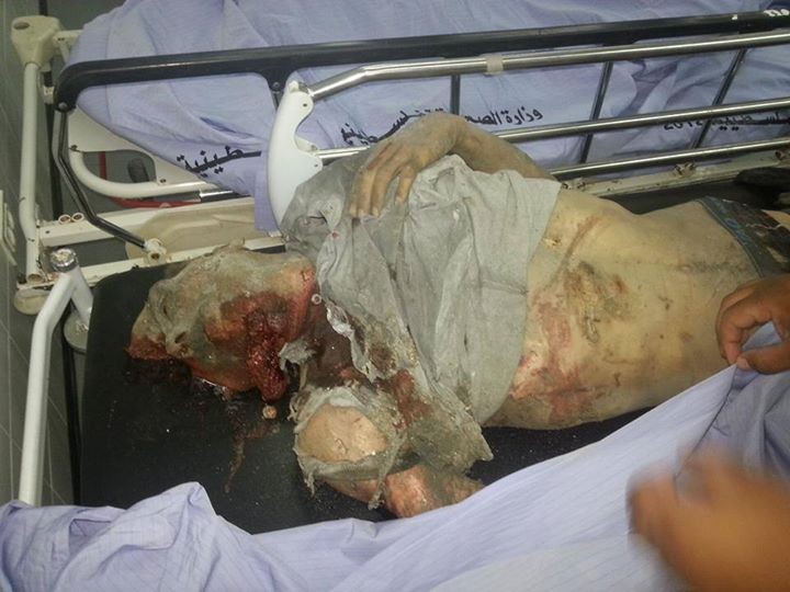 تازه‌ترین جنایت صهیونیست‌ها در غزه+ تصاویر(18+)