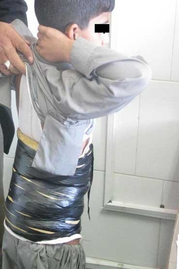 عکس/ جاسازی تریاک در بدن مسافر