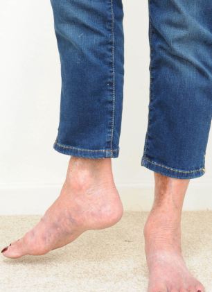 عجیب ترین پای دنیا! +عکس