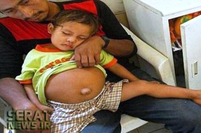 ماجرای عجیب بارداری یک کودک سه ساله!+عکس ماجرای عجیب بارداری یک کودک سه ساله!+عکس