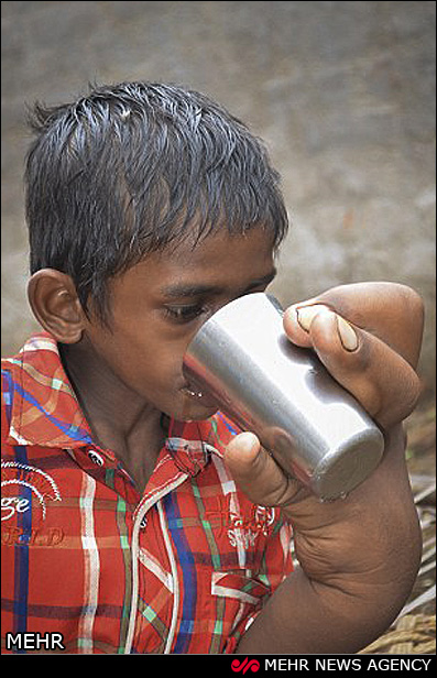 تصاویر/ کودک هندی با دستان غول پیکر‎