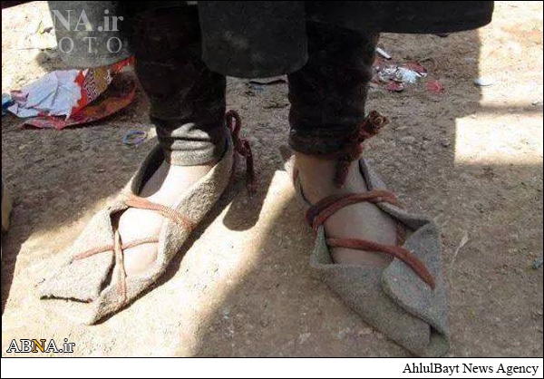 کفش‌های دختر آواره ایزدی+عکس