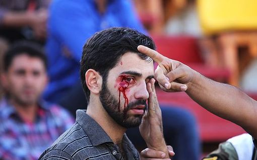 عکس/ حاشیه خونین پدیده و سپاهان