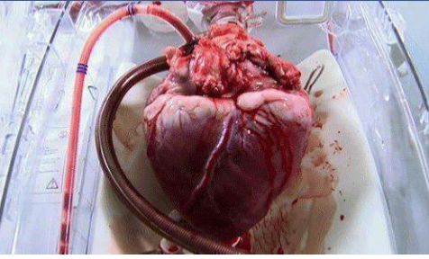 عکس/ قلب زنده قبل از عمل پیوند عکس/ قلب زنده قبل از عمل پیوند