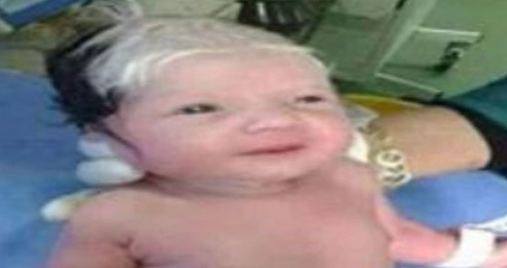 نوزاد لبنانی، پیرمرد به دنیا آمد!+ عکس