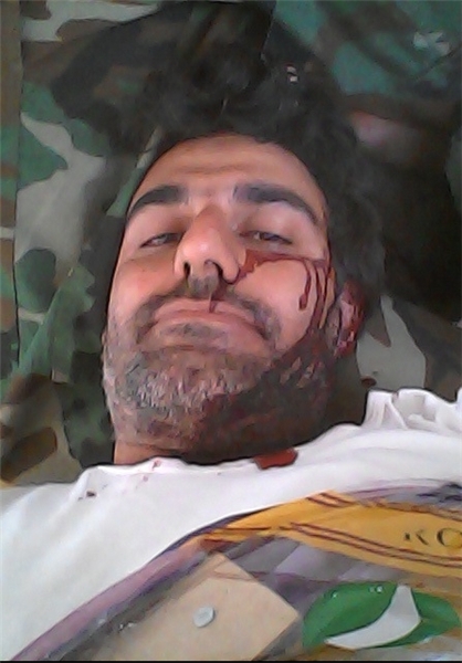 مستندسازی که توسط داعش مجروح شد +فیلم و تصاویر