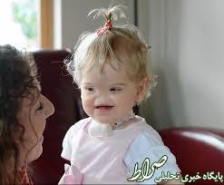 نوزادی که بینی ندارد +تصاویر نوزادی که بینی ندارد +تصاویر