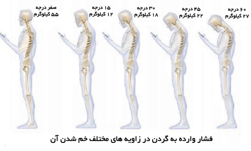 7 ضرر موبایل هوشمند برای سلامتی