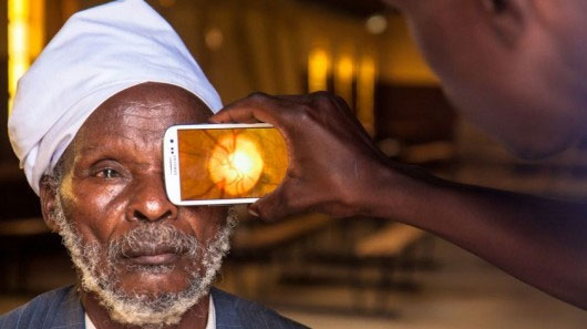 معاینه چشم با تلفن هوشمند! +عکس