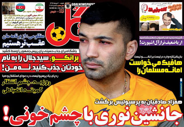 عکس/ جانشین نوری با چشم خونی!