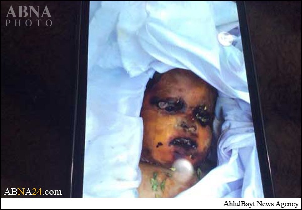 جنجال تجاوز و قتل یک کودک در کابل+عکس