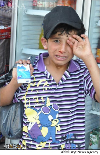 ضرب‌وشتم کودک سوری در ترکیه+تصاویر