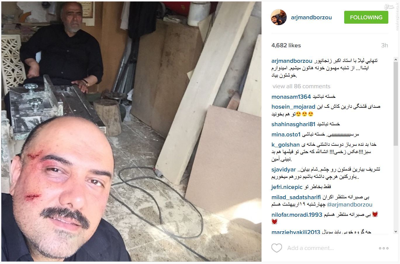 عکس/ سلفی برزوارجمند پس از کتکخوردن عکس/ سلفی برزوارجمند پس از کتکخوردن