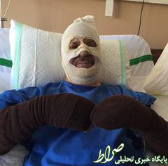 آهنگساز معروف در انفجار خانهاش سوخت آهنگساز معروف در انفجار خانهاش سوخت