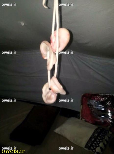 عکس/دختری که گوش داعشیها را می برد/+۱۸ عکس/دختری که گوش داعشیها را می برد/+۱۸