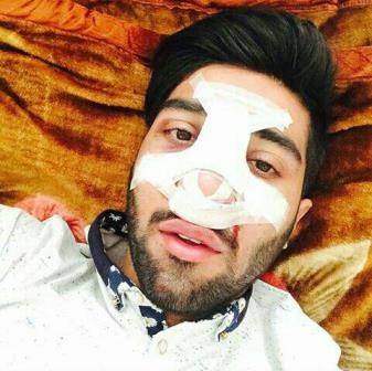 بینی بازیکن استقلال شکست بینی بازیکن استقلال شکست