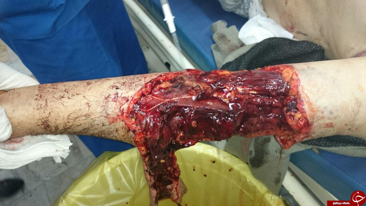 حمله یک خرس به پیرمردالموتی+تصاویر