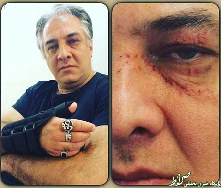 ایرج نوذری دچار سانحه شد +عکس ایرج نوذری دچار سانحه شد +عکس