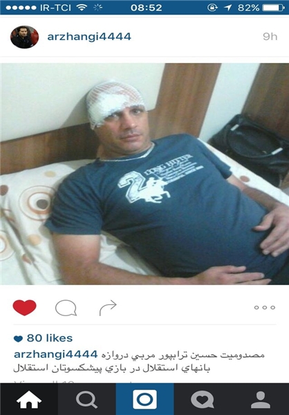 عکس/مصدومیت مربی دروازه‌بانان استقلال