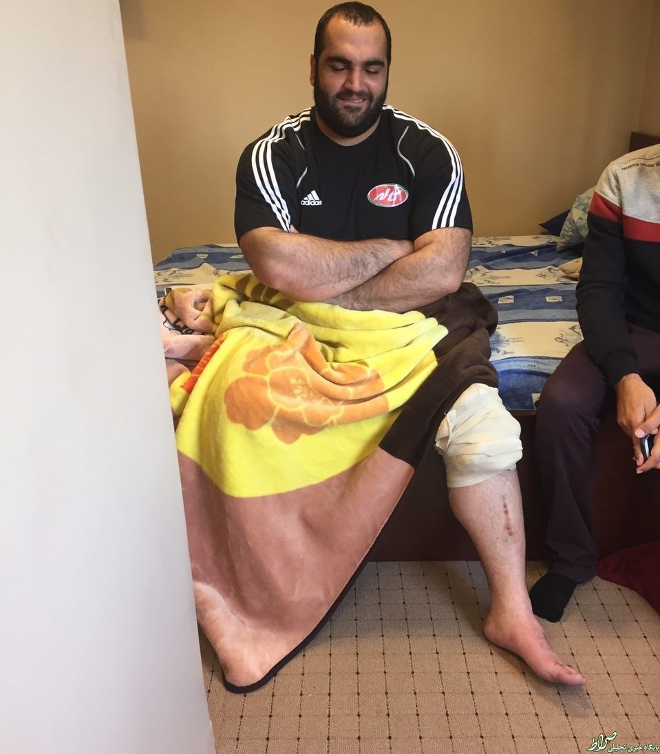 عکس بهداد سلیمی پس از مصدومیت عکس بهداد سلیمی پس از مصدومیت