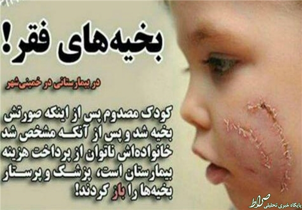 حواشی اینترنتی حادثه تلخ بخیه +تصاویر حواشی اینترنتی حادثه تلخ بخیه +تصاویر