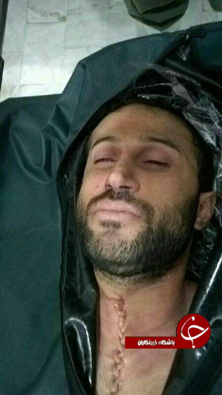 عکس چهره اولادی در پزشکی قانونی