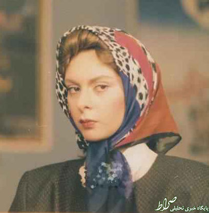 اولین بازیگری که جراحی زیبایی کرد+عکس اولین بازیگری که جراحی زیبایی کرد+عکس