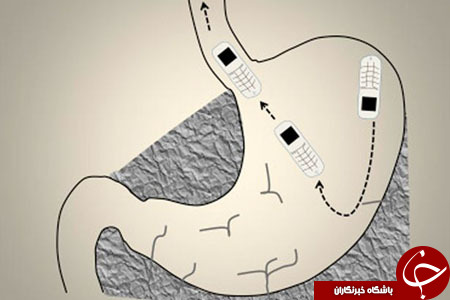 نجات زندانی پس از بلعیدن گوشی +تصاویر