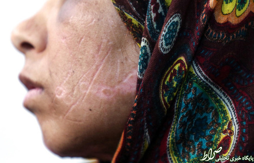 شکنجه 21 روزه زن بی پناه+تصاویر شکنجه 21 روزه زن بی پناه+تصاویر