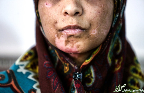 شکنجه 21 روزه زن بی پناه+تصاویر شکنجه 21 روزه زن بی پناه+تصاویر