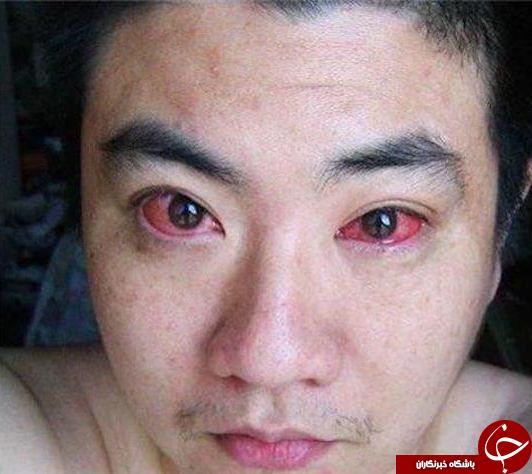 عکس/ پیامد استفاده مداوم از موبایل درشب