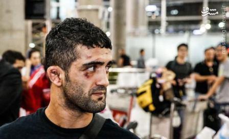 عکس/ زخمهایی به رنگ طلا عکس/ زخمهایی به رنگ طلا