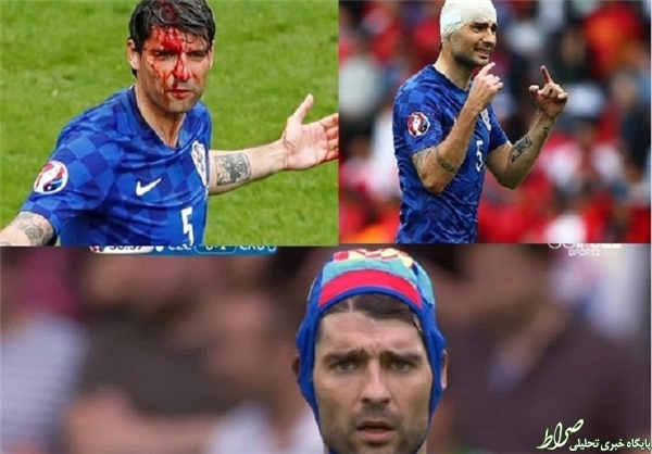 عکس/ مصدومیت بازیکن کرواسی سوژه شد