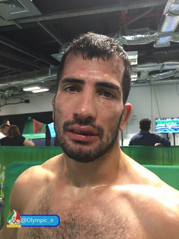 عکس/ چهره خسته و خونین امید نوروزی