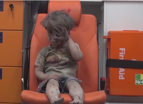زخم‌های کودک مظلوم سوری +تصاویر
